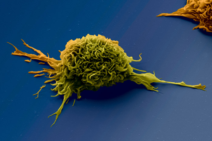 Immunoregulatory and Inflammation Laboratory