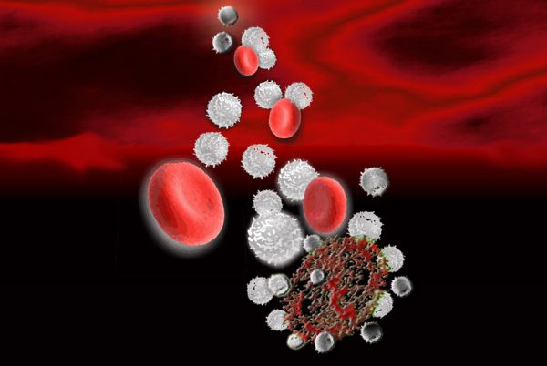 Chronic Lymphoid Leukemia Laboratory